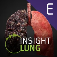 INSIGHT LUNG Enterprise